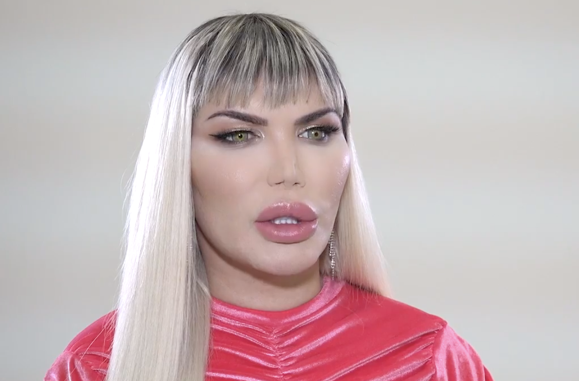 Human Ken Doll Rodrigo Alves Becomes World S First Man To Have Four