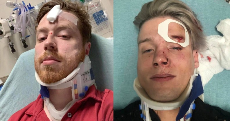 Texas gay couple Spencer Deehring and Tristan Perry were both hospitalised after the brutal anti-gay attack.