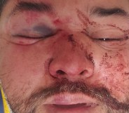 Phoenix resident Cesar Marin says he was attacked by a mob of 10 people.