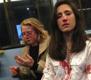 London bus attack Two women on a London bus covered in blood after alleged homophobic attack