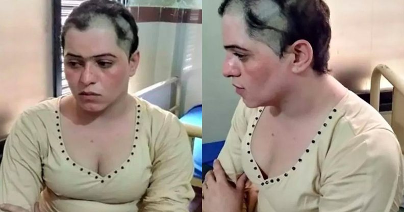 A Pakistani transgender woman with cropped hair and bald batches
