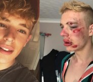 Ryan Turner was beaten up for being gay