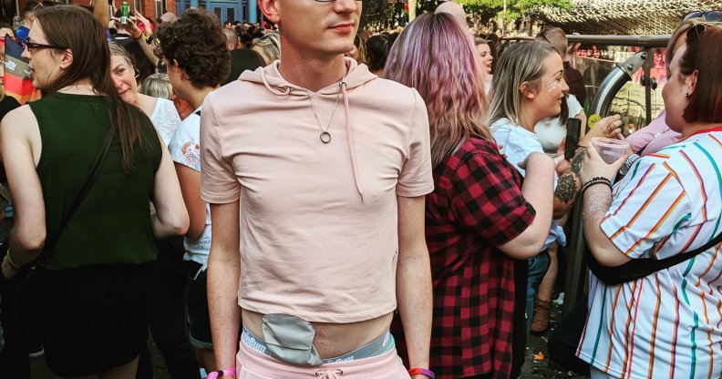 Man shows off ileostomy bag at Manchester Pride for an important reason