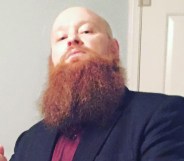 Preacher Todd Bentley (Facebook/Todd Bentley)