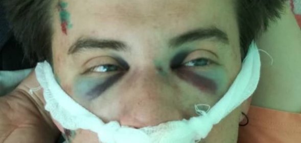 Belorussian filmmaker Nikolai Kuprich suffered a broken nose and severe head injuries