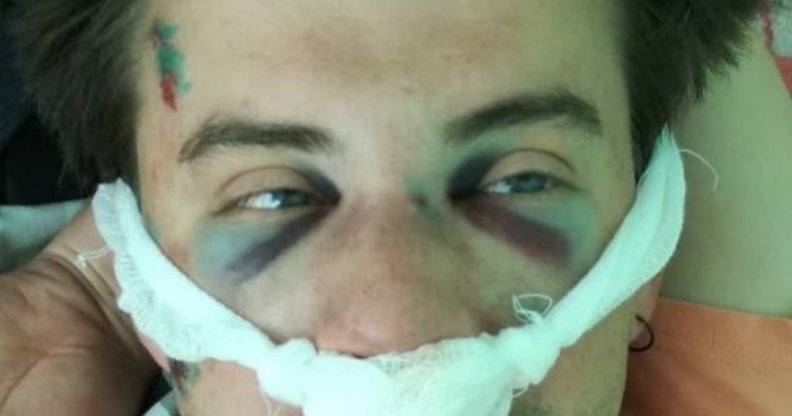 Belorussian filmmaker Nikolai Kuprich suffered a broken nose and severe head injuries
