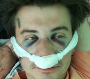 Belorussian filmmaker Nikolai Kuprich suffered a broken nose and severe head injuries