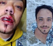 A gay man was viscously assaulted by a gang after kissing his boyfriend in Dublin. (Danilo Matta)