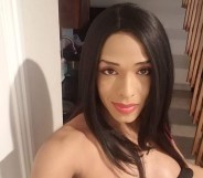 Daniela Calderon Rivera, of Dallas, was left with horrific injuries