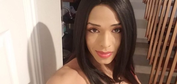 Daniela Calderon Rivera, of Dallas, was left with horrific injuries