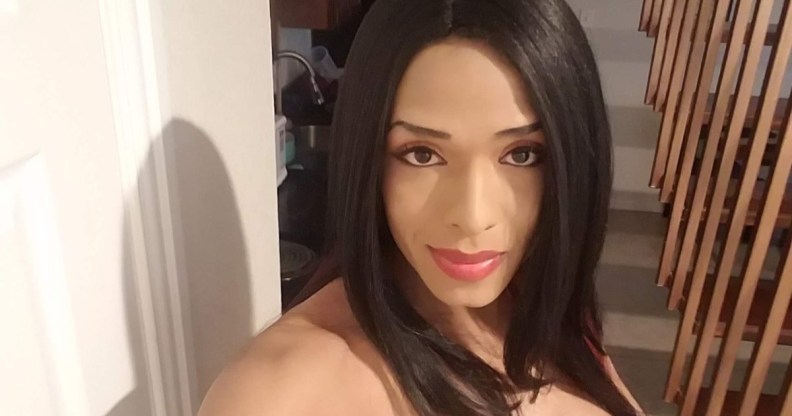 Daniela Calderon Rivera, of Dallas, was left with horrific injuries