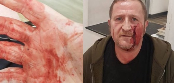 Gay man who meant to meet someone from Grindr ambushed and attacked by teen gang with hammers in hate crime