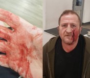 Gay man who meant to meet someone from Grindr ambushed and attacked by teen gang with hammers in hate crime