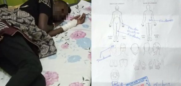 After discovering she is a lesbian, a Ugandan doctor allegedly pummelled his patient with an iron bar. (Twitter)