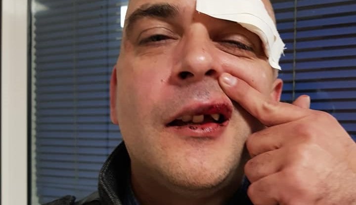 Ilija Vučević was left needing medical treatment after the attack, and shared a bloody selfie on Facebook.