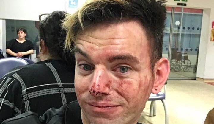 Lee Brobson bravely stood up for his pals before being brutally beaten up by two men. (Facebook)