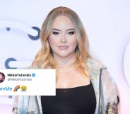 NikkieTutorials has come out as trans in a tear-jerking video. (Getty Images)