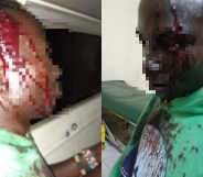 Stephen Sebuuma, a trans refugee based in the Kakuma camp in Kenya, was brutally stabbed by transphobes. (Facebook)