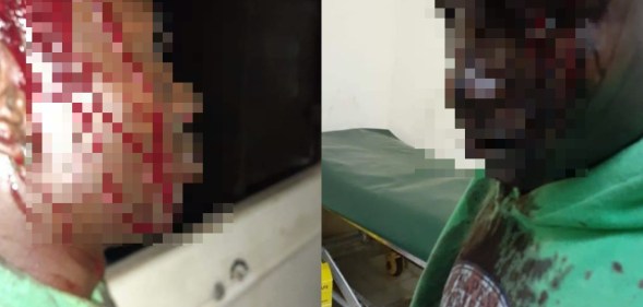 Stephen Sebuuma, a trans refugee based in the Kakuma camp in Kenya, was brutally stabbed by transphobes. (Facebook)