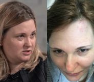 Novaya Gazeta reporter Elena Milashina, who helped expose the gay purge that pelted Chechnya, was attacked. (Screen capture via The Moscow Times/Facebook)