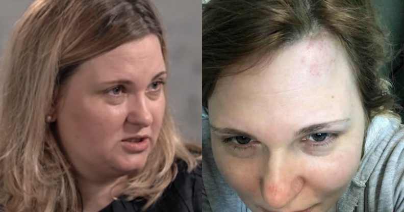 Novaya Gazeta reporter Elena Milashina, who helped expose the gay purge that pelted Chechnya, was attacked. (Screen capture via The Moscow Times/Facebook)