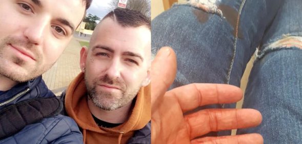 Teen arrested over homophobic assault that saw gay couple stabbed