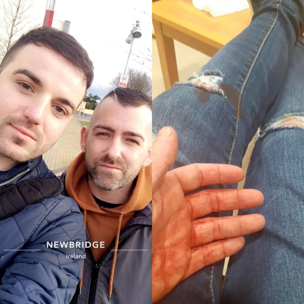 Teen arrested over homophobic assault that saw gay couple stabbed