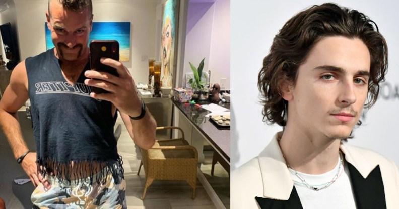 Armie Hammer Timothee Chalamet makeover