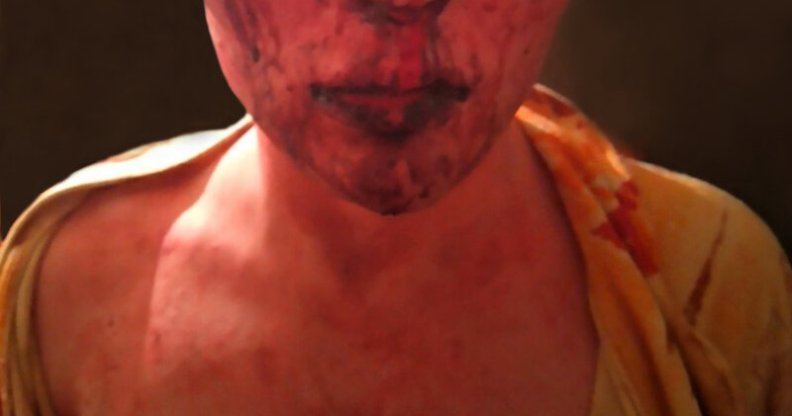 Ukraine: Trans youth chased home naked and bleeding after brutal attack