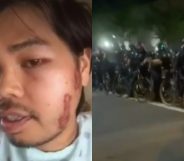 Tee Fansofa was shot, they claimed, twice with rubber bullets and once with a tear gas canister by Sacramento Police Department officers. (Screen captures via CBS)