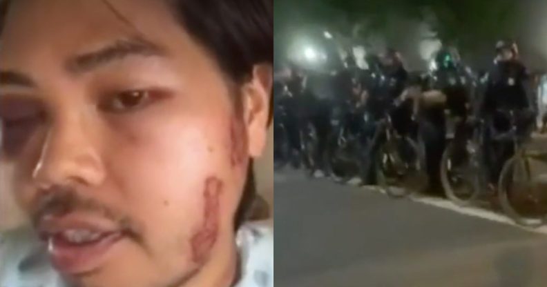 Tee Fansofa was shot, they claimed, twice with rubber bullets and once with a tear gas canister by Sacramento Police Department officers. (Screen captures via CBS)