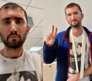 Jason Rosenberg New York City Black Lives Matter arrest