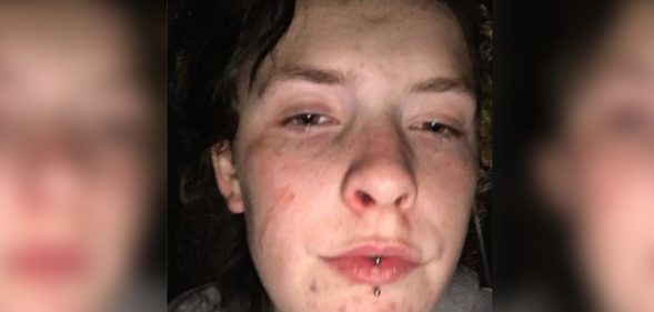 Queer 16-year-old viscously beaten by thugs in vile homophobic attack