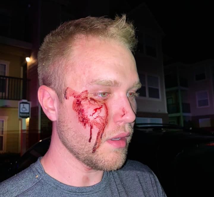 Christian Council: Thugs beat gay man unconscious while screaming slurs