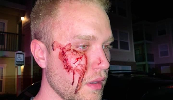Christian Council: Thugs beat gay man unconscious while screaming slurs