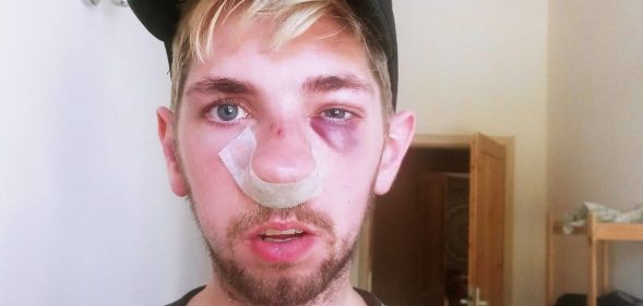 Poland: Gay man beaten up with 'telescopic baton' in broad daylight