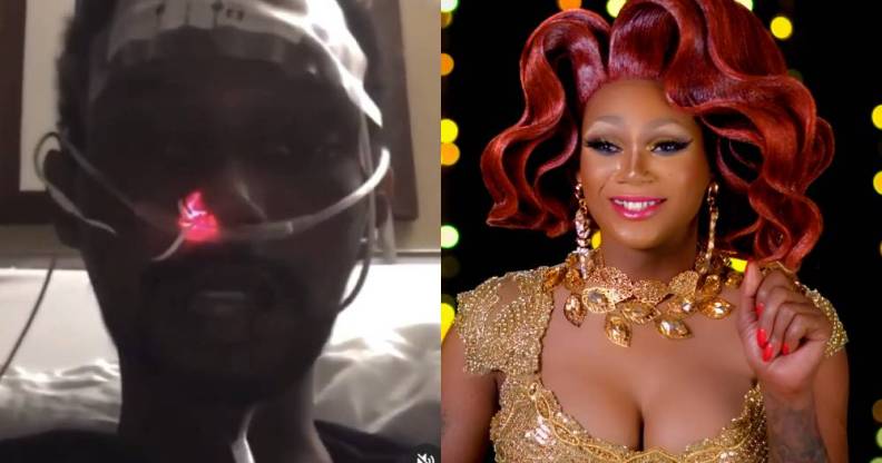 Chi Chi DeVayne with a feeding tube in her nose / Chi Chi in full drag