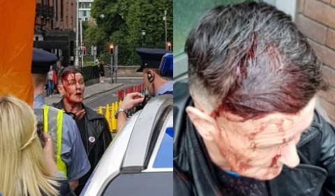 Izzy Kamikaze LGBT activist Dublin far right protest