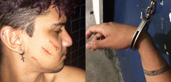Lorran Oliveira, a 21-year-old photographer, was beaten with a broomstick by a neighbour. (Facebook)