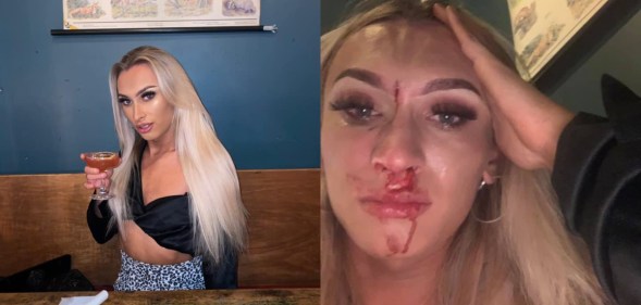 Anna Montgomery was beaten while she was enjoying drinks with her boyfriend in a bar. (Facebook)