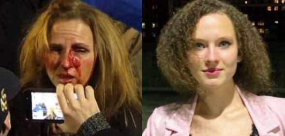 Therese Duke covered in blood. Helena Duke looks to the camera in a black top and pastel pink blazer