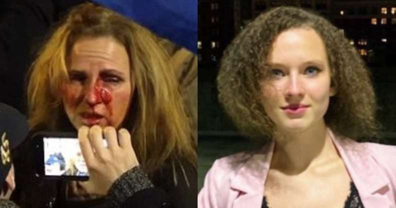 Therese Duke covered in blood. Helena Duke looks to the camera in a black top and pastel pink blazer