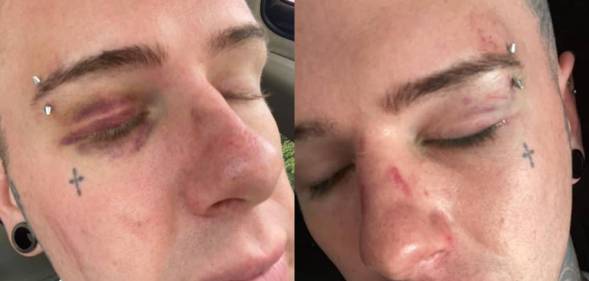 Ray Gardiner Auckland New Zealand Pride assault