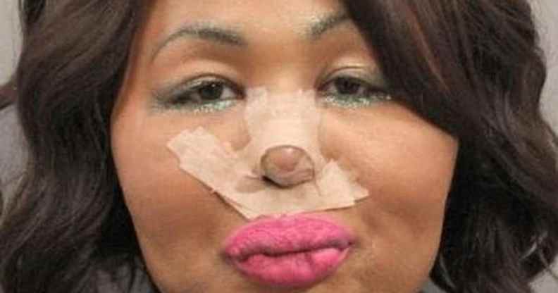 Iconic Facce, who robbed banks to pay for gender-affirming healthcare