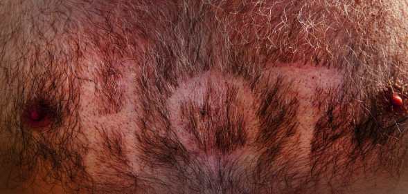 A hairy, male chest with the word HOT shaved into it, Glastonbury Festival 2010.