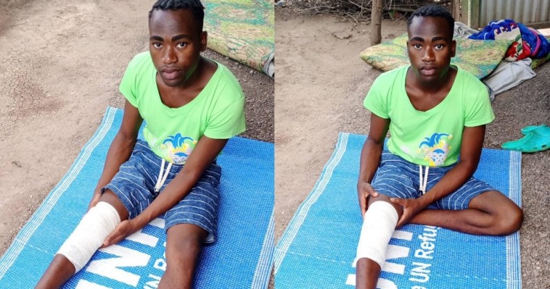 Canary Murungi sits on a UNCHR mat with his knee bandaged