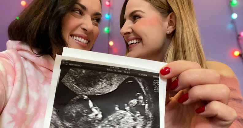Rose and Rosie holding an ultrasound photo