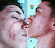 Side-by-side of Ruan Filipe with cuts on his face, cheeks and neck