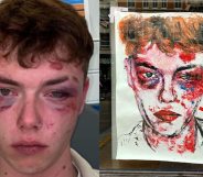 Josh Ormrod after he was attacked, and his portrait in Cardiff city centre