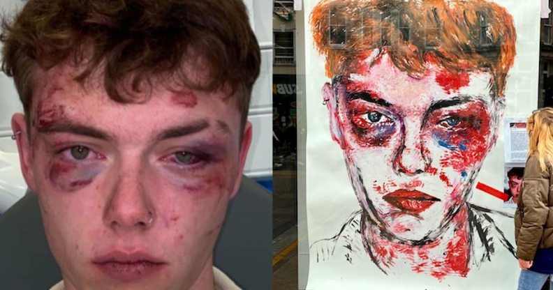 Josh Ormrod after he was attacked, and his portrait in Cardiff city centre